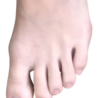toe